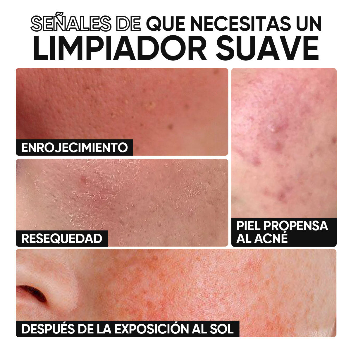 Limpiador facial 5X Ceramidas pH bajo