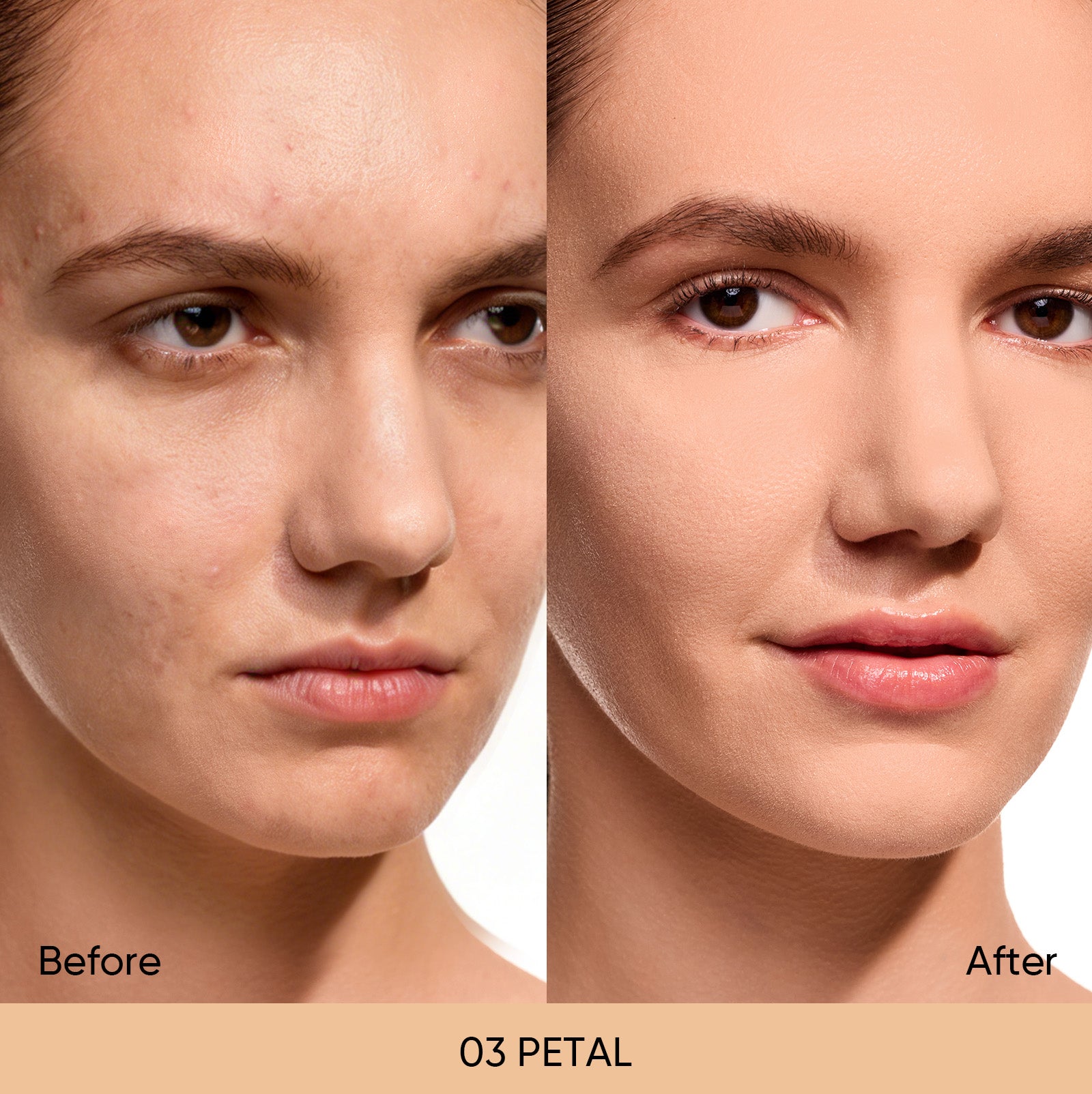 03 PETAL